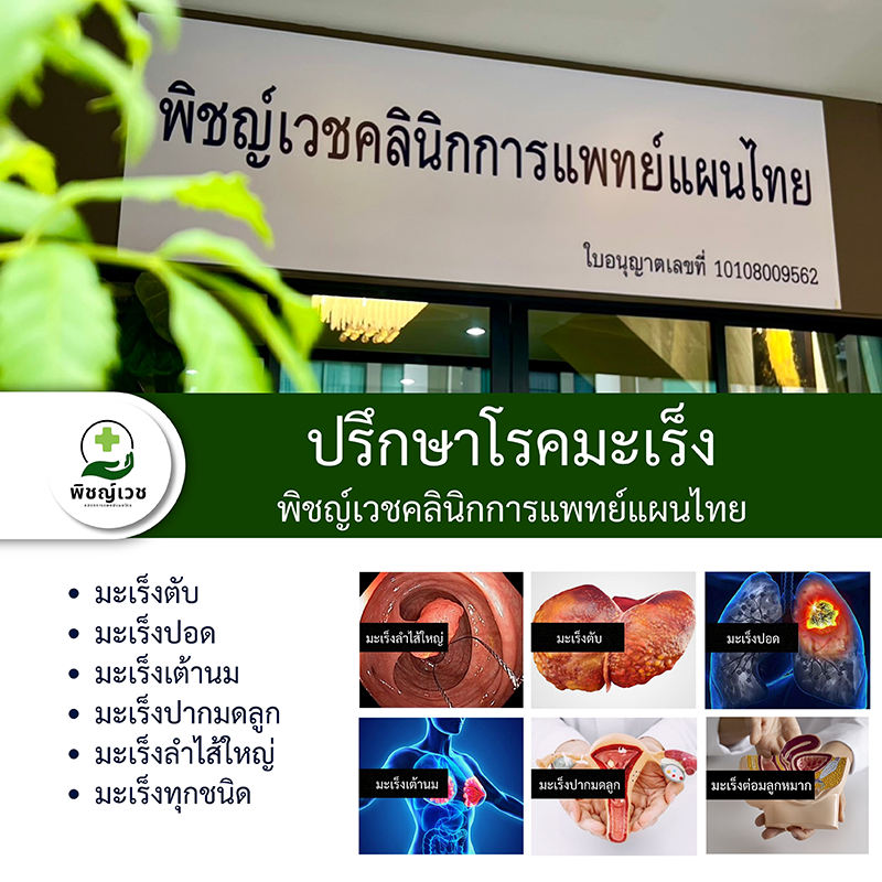มะเร็งทุกระยะปรึกษาแพทย์