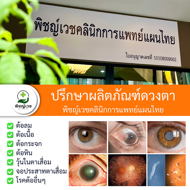 ปรึกษาปัญหาดวงตา