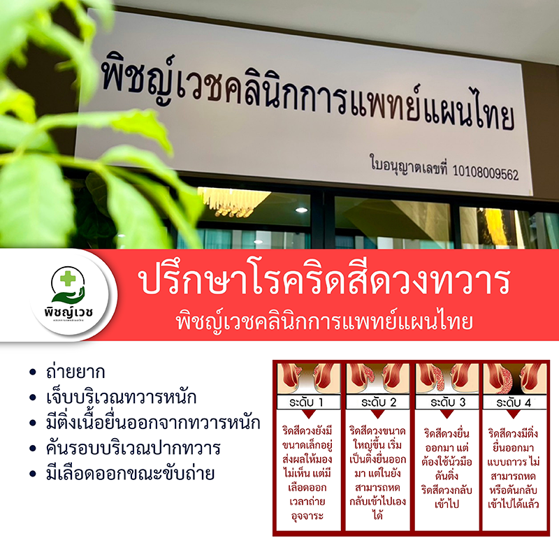 ปรึกษาโรคริดสีดวงทวาร